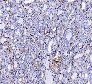 Anti-SH3GL2 Antibody