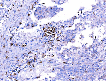 Anti-SH3GL2 Antibody