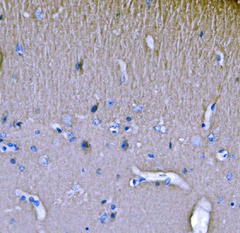 Anti-SH3GL2 Antibody