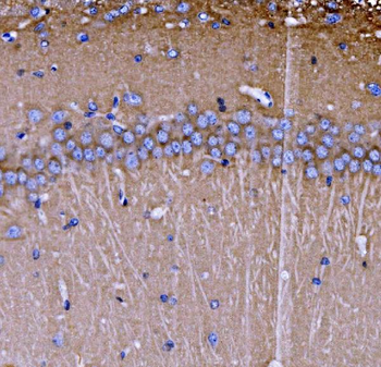 Anti-SH3GL2 Antibody