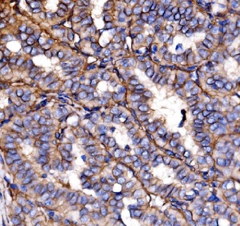 Anti-NEAS/SPTAN1 Antibody
