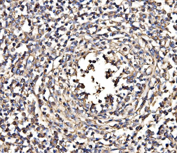 NEAS/SPTAN1 Antibody