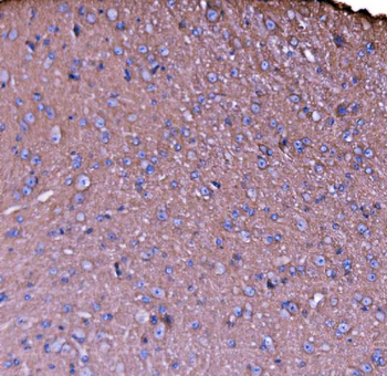 Anti-NEAS/SPTAN1 Antibody