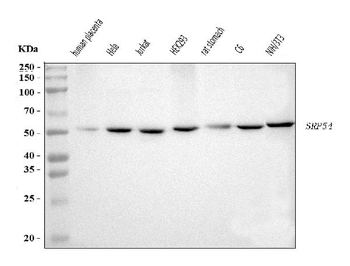 Anti-SRP54 Antibody