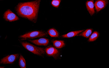 Anti-SRP72 Antibody