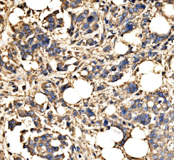 Anti-SRP72 Antibody