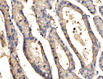 Anti-SRP72 Antibody