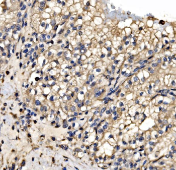 Anti-SRP72 Antibody