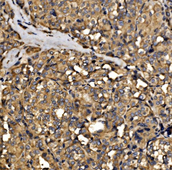 Anti-SRP72 Antibody