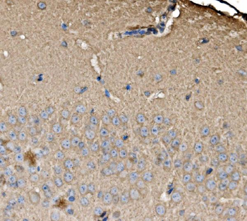 Anti-SRP72 Antibody