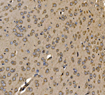 Anti-SRP72 Antibody