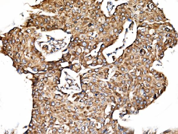 Anti-TIMM29 Antibody