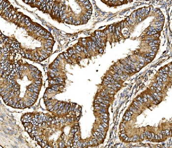 Anti-TIMM29 Antibody