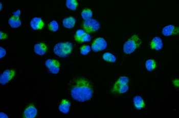 TIMM29 Antibody