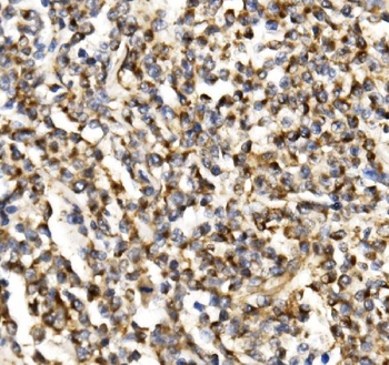 Anti-TIMM29 Antibody