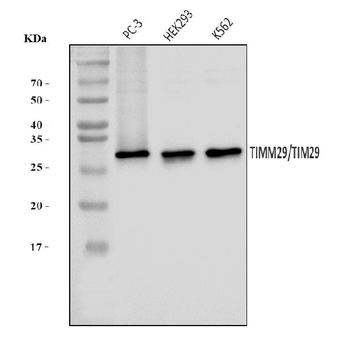 Anti-TIMM29 Antibody