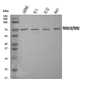 Anti-TNF Receptor II/TNFRSF1B Antibody