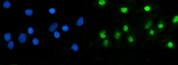 Anti-USP5 Antibody