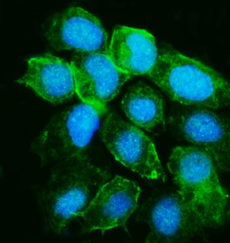 Anti-YARS1 Antibody