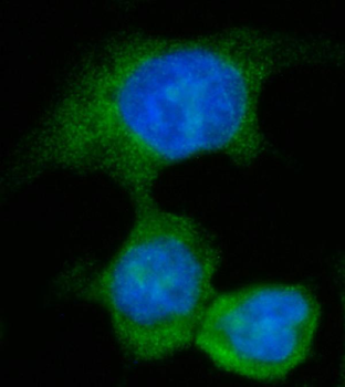 Anti-AASS Antibody