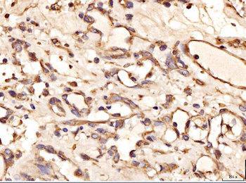 Anti-AASS Antibody