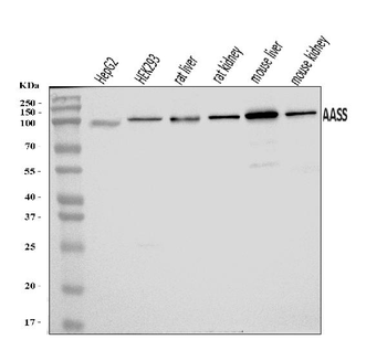Anti-AASS Antibody