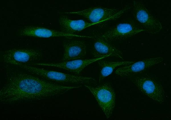 ADAM9 Antibody