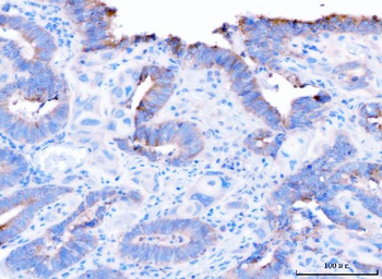 Anti-ADAM9 Antibody