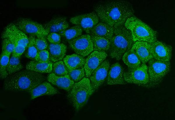 Anti-ADORA2B Antibody