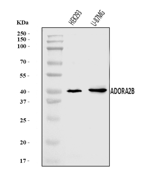 Anti-ADORA2B Antibody