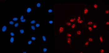 Anti-AKAP 95/AKAP8 Antibody