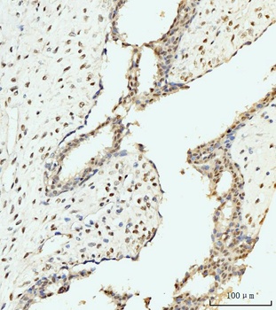 AKAP 95/AKAP8 Antibody