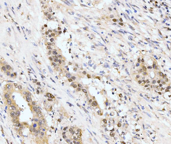 Anti-AKAP 95/AKAP8 Antibody