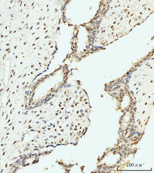 Anti-AKAP 95/AKAP8 Antibody