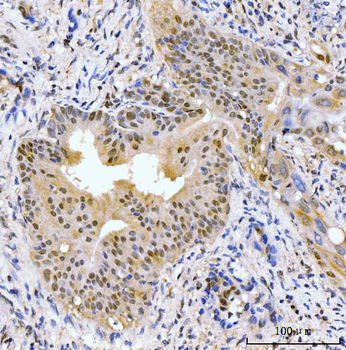 Anti-AKAP 95/AKAP8 Antibody