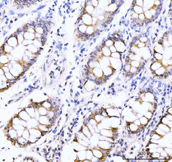 Anti-AKAP 95/AKAP8 Antibody