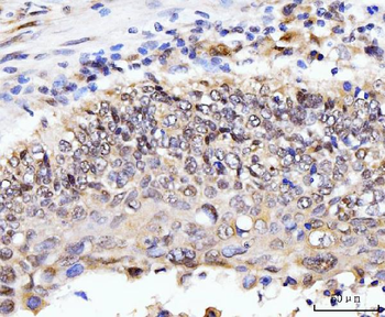 Anti-AKAP 95/AKAP8 Antibody