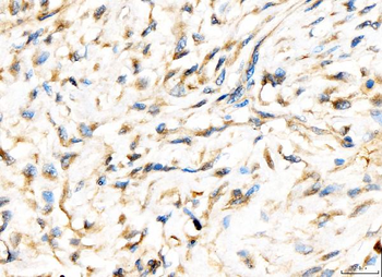 Anti-AP2A2 Antibody