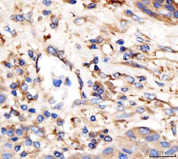 Anti-AP2A2 Antibody