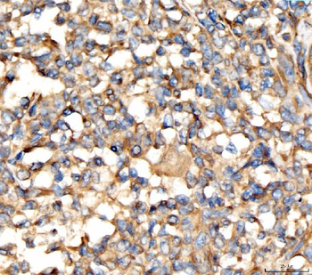 Anti-AP2A2 Antibody