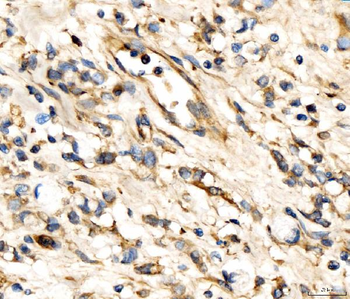 Anti-AP2A2 Antibody