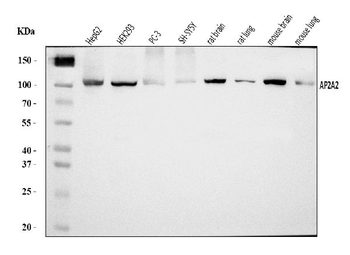 Anti-AP2A2 Antibody