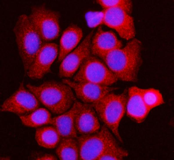 Anti-BCKDK Antibody