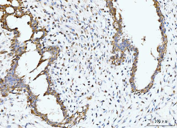 Anti-BCKDK Antibody
