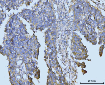 Anti-BCKDK Antibody