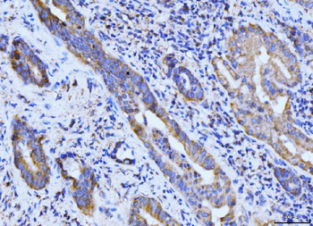 Anti-BCKDK Antibody