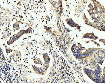 Anti-BCKDK Antibody