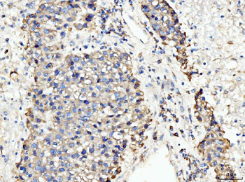 Anti-BCKDK Antibody