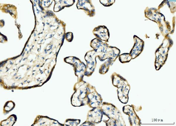 Anti-BCKDK Antibody