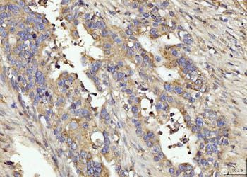 Anti-BIN1 Antibody